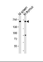 ZCCHC11 Polyclonal Antibody