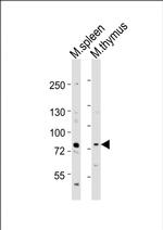 MELK Polyclonal Antibody