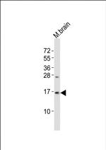 LC3B Antibody in Western Blot (WB)