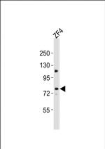 MTM1 Polyclonal Antibody