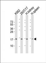 NFE4 Polyclonal Antibody