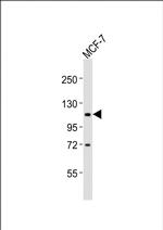 ADAMTS15 Polyclonal Antibody