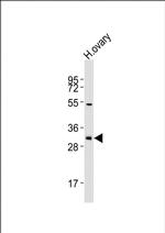 NBPF12 Polyclonal Antibody