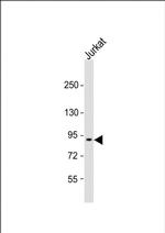 CTAGE6 Polyclonal Antibody