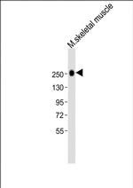 Myosin Heavy Chain Antibody in Western Blot (WB)