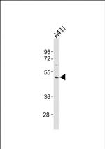 MMP23 Polyclonal Antibody