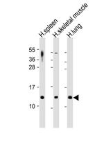 TARC Polyclonal Antibody
