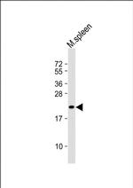 SEC11C Polyclonal Antibody