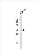 STPG1 Polyclonal Antibody
