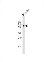 POTEM Polyclonal Antibody