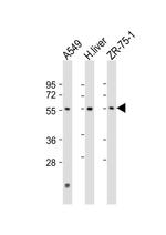 PM20D1 Antibody in Western Blot (WB)