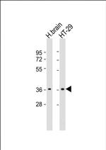 OR2T7 Polyclonal Antibody
