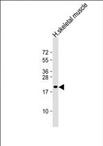 NACA2 Polyclonal Antibody