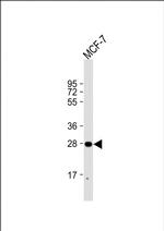 H1FNT Polyclonal Antibody