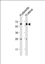 ZBTB7C Polyclonal Antibody