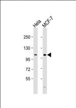 VLDLR Polyclonal Antibody