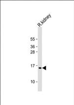 ATP5G3 Polyclonal Antibody