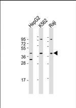 FGFR1OP Polyclonal Antibody