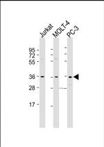 HUG1 Antibody in Western Blot (WB)