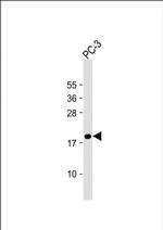 MEAF6 Polyclonal Antibody
