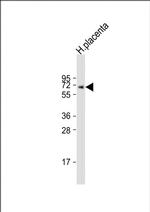 ERVK-7 Polyclonal Antibody
