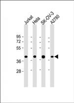 GBGT1 Polyclonal Antibody