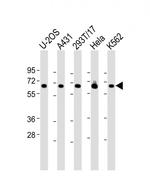RSL1D1 Polyclonal Antibody