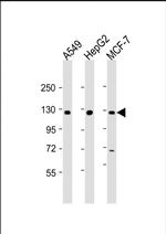 KLB Polyclonal Antibody