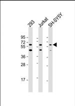 HEXDC Polyclonal Antibody
