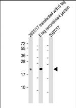 S1 tag Polyclonal Antibody