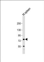 Kindlin 3 Polyclonal Antibody