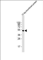 HSV Tag Polyclonal Antibody
