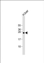 GSTA5 Polyclonal Antibody