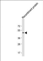 TrpE Tag Antibody in Western Blot (WB)