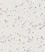 UT-A1 Polyclonal Antibody