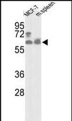PANK1 Polyclonal Antibody