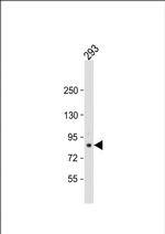 TARSL2 Polyclonal Antibody
