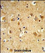 Dynamin 3 Polyclonal Antibody