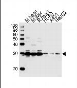 SDHB Polyclonal Antibody