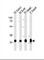 SDHB Antibody in Western Blot (WB)