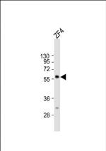 RIC8B Antibody in Western Blot (WB)