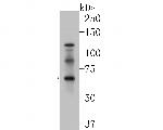 GABRA4 Antibody in Western Blot (WB)