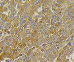 MGST1 Antibody in Immunohistochemistry (Paraffin) (IHC (P))