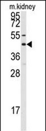 Connexin 50 Antibody in Western Blot (WB)