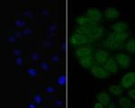 BCL6 Polyclonal Antibody