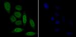 CDKN2B Antibody in Immunocytochemistry (ICC/IF)