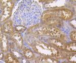 CDKN2B Antibody in Immunohistochemistry (Paraffin) (IHC (P))