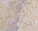 CDKN2B Antibody in Immunohistochemistry (Paraffin) (IHC (P))