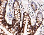 Cytokeratin 20 Antibody in Immunohistochemistry (Paraffin) (IHC (P))