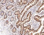 Cytokeratin 20 Polyclonal Antibody